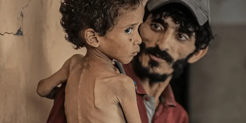 Yezen-Abu-Ful-un-nino-de-2-anos-que-vive-con-su-familia-en-el-campo-de-refugiados-de-Al-Shati-en-julio-de-2025