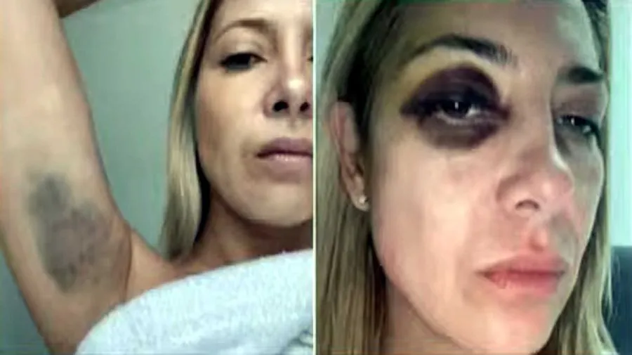 fabiola-yanez-golpeada-20240808-1850994